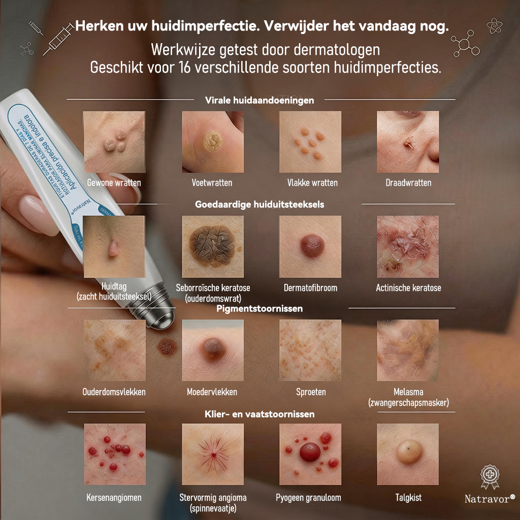 Officiële merkshop | 🖊️Natravor® 7-daagse wratten- en vlekkenverwijderaar (pijnstillende applicator voor nauwkeurig aanbrengen, laat geen littekens achter)🌳