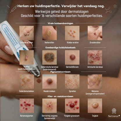 Officiële merkshop | 🖊️Natravor® 7-daagse wratten- en vlekkenverwijderaar (pijnstillende applicator voor nauwkeurig aanbrengen, laat geen littekens achter)🌳