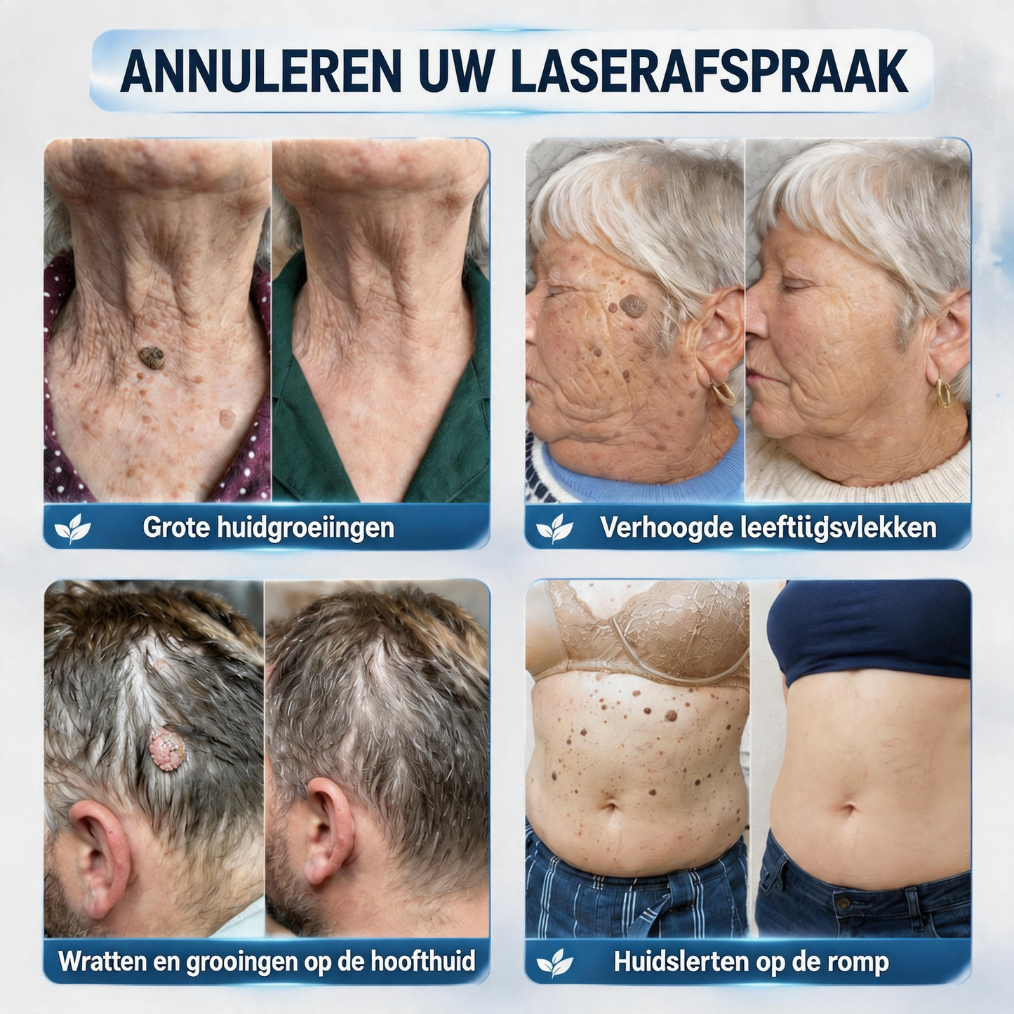 Officiële merkshop | 🖊️Natravor® 7-daagse wratten- en vlekkenverwijderaar (pijnstillende applicator voor nauwkeurig aanbrengen, laat geen littekens achter)🌳